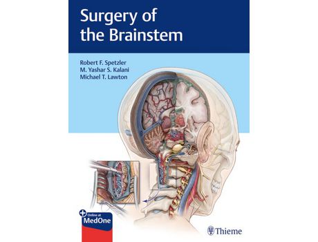 Livro Livro Surgery of the Brainstem de Vários Autores (Inglês) de Robert F Spetzler, M Yashar Kalani, Michael Lawton ( Inglês )