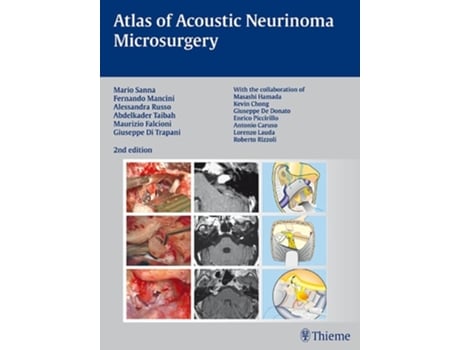 Livro Atlas of Acoustic Neurinoma Microsurgery de Mario Sanna (Inglês - Capa Dura)