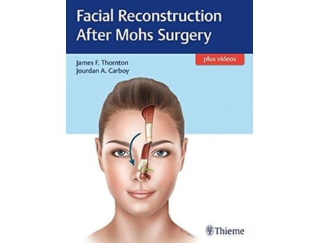 Livro Facial Reconstruction After Mohs Surgery de James F Thornton (Inglês - Capa Dura)