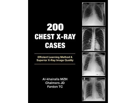 Livro 200 Chest XRay Cases de Mudher AlKhairalla James Chalmers Tom Fardon (Inglês)