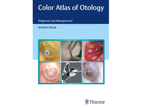 Livro Color Atlas of Otology de Anirban Ghosh (Inglês - Capa Dura)