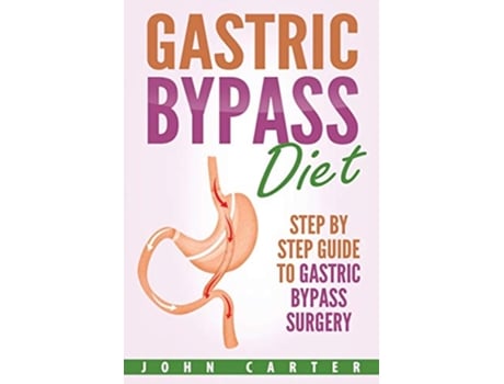 Livro Gastric Bypass Diet Step By Step Guide to Gastric Bypass Surgery Bariatric Cookbook de John Carter (Inglês)