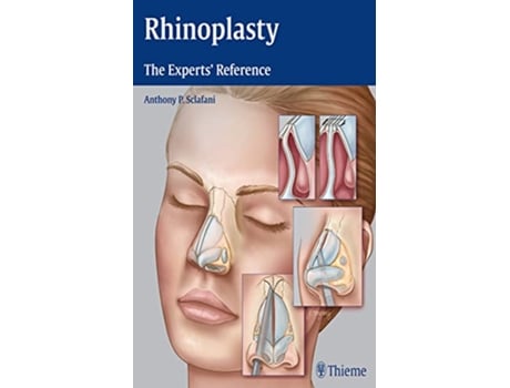 Livro Rhinoplasty de Anthony P Sclafani (Inglês - Capa Dura)