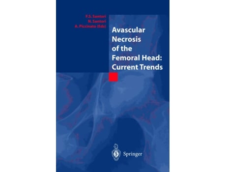 Livro Avascular Necrosis of the Femoral Head Current Trends de Editor Fs Santori, N Santori et al. (Inglês - Capa Dura)