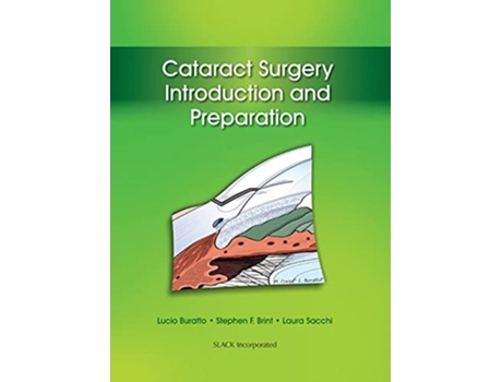 Livro Cataract Surgery de Lucio Buratto Md, Stephen Brint Md et al. (Inglês - Capa Dura)