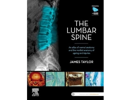 Livro The Lumbar Spine de James Taylor (Inglês)