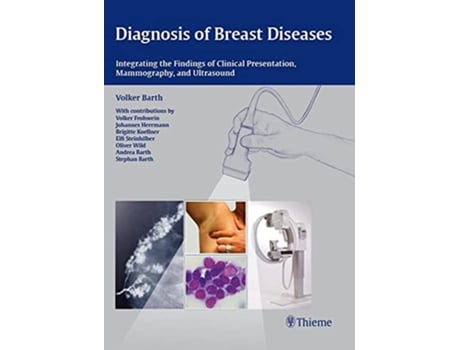 Livro Diagnosis of Breast Diseases Integrating the Findings of Clinical Presentation Mammography and Ultrasound de Volker Barth (Inglês)