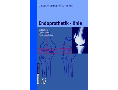 Livro Endoprothetik Knie German Edition de L Rabenseifner e C Trepte (Alemão - Capa Dura)