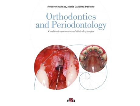 Livro Orthodontics and Periodontology de Roberto Kaitsas e Maria Giacinta Paolone (Inglês - Capa Dura)