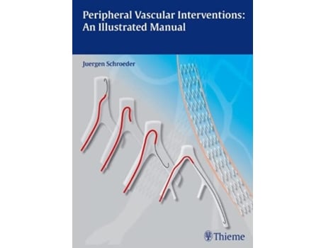 Livro Peripheral Vascular Interventions An Illustrated Manual de Jürgen Schröder (Inglês)