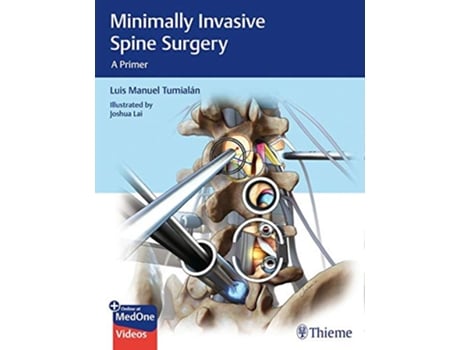 Livro Minimally Invasive Spine Surgery de Luis Manuel Tumialan (Inglês - Capa Dura)