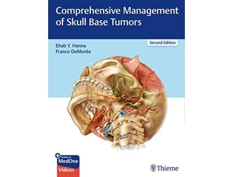 Livro Comprehensive Management of Skull Base Tumors de Ehab Y Hanna e Franco Demonte (Inglês - Capa Dura)