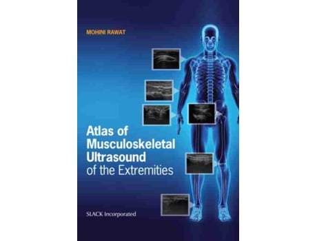 Livro Atlas of Musculoskeletal Ultrasound of the Extremities de Mohini Rawat Dpt Ms Ecs Ocs Rmsk (Inglês)