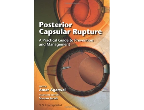 Livro Posterior Capsular Rupture de Amar Agarwal Ms Frcs Frcophth (Inglês)