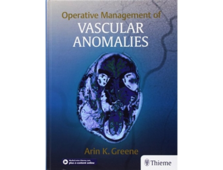 Livro Operative Management of Vascular Anomalies de Arin K Greene (Inglês - Capa Dura)