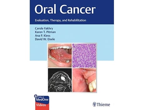 Livro Oral Cancer de Carole Fakhry, Karen T Pitman et al. (Inglês - Capa Dura)