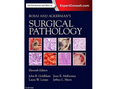 Livro Rosai And Ackerman'S Surgical Pathology - 2 Volume Set.(11Th Edition) de Lamps Goldblum (Inglês)