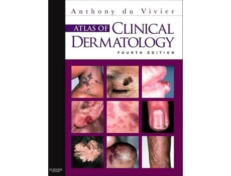 Livro Atlas Of Clinical Dermatology de Anthony Du Vivier (Inglés)