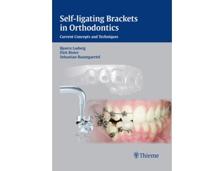 Livro Selfligating Brackets in Orthodontics Current Concepts and Techniques de Dirk Bister Sebastian Baumgaertel Björn Ludwig (Inglês)