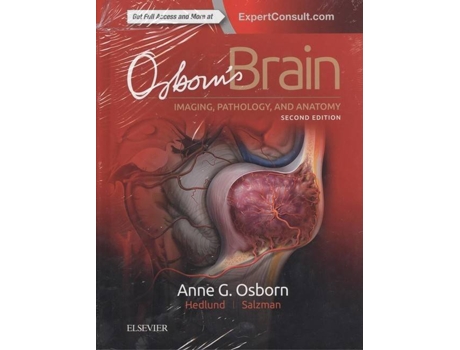 Livro Osborn'S Brain de Anne Osborn (Inglês)
