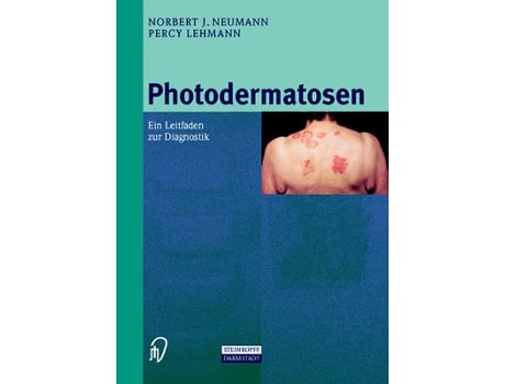 Livro Photodermatosen Ein Leitfaden zur Diagnostik German Edition de Nj Neumann e Percy Lehmann (Alemão)