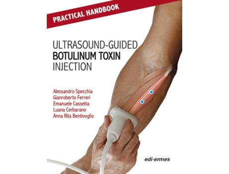 Livro Practical Handbook for Ultrasoundguided Botulinum Toxin Injection de Alessandro Specchia, Gianroberto Ferreri et al. (Inglês)