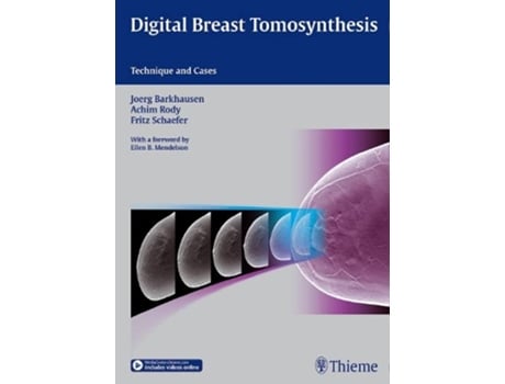 Livro Digital Breast Tomosynthesis Technique and Cases de Joerg Barkhausen Achim Rody Fritz KW Schäfer (Inglês)